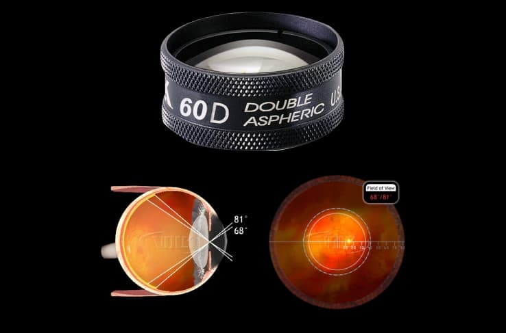 Kính Volk dùng kèm đèn khe Slit Lamp