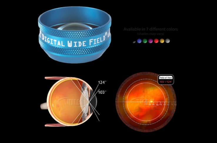 Kính Volk dùng kèm đèn khe Slit Lamp