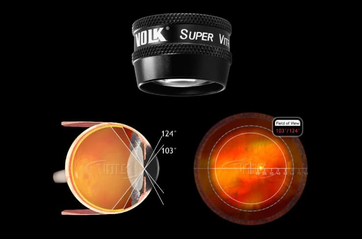 Kính Volk dùng kèm đèn khe Slit Lamp