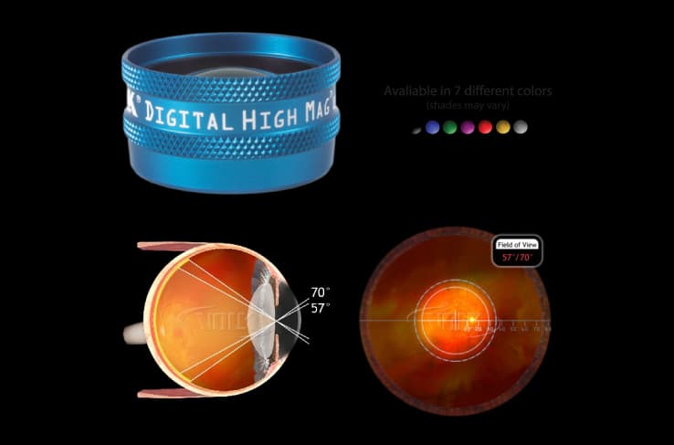 Kính Volk dùng kèm đèn khe Slit Lamp