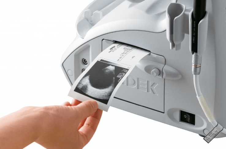 Siêu âm mắt AB US-4000/500