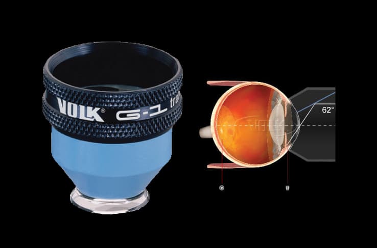 Kính Volk dùng cho soi góc tiền phòng